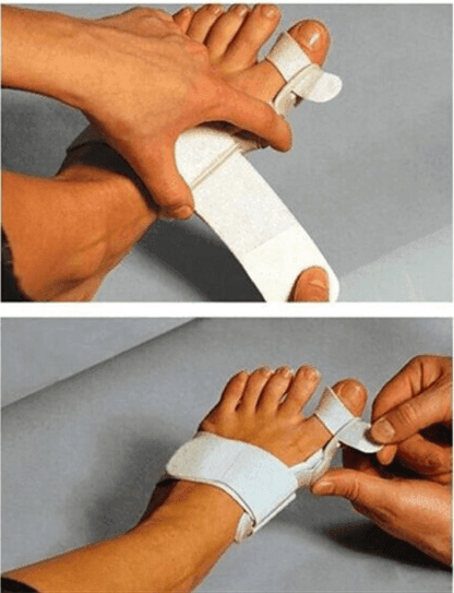 Hallux Valgus Corrector With Foot Valgus Separator - HEPSIBAH SHOP